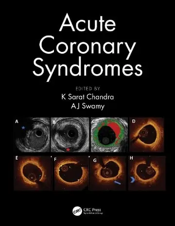 Cover of Acute Coronary Syndromes