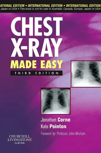 Cover of Chest X-Ray Made Easy Jonathan Corne and Kate Pointon