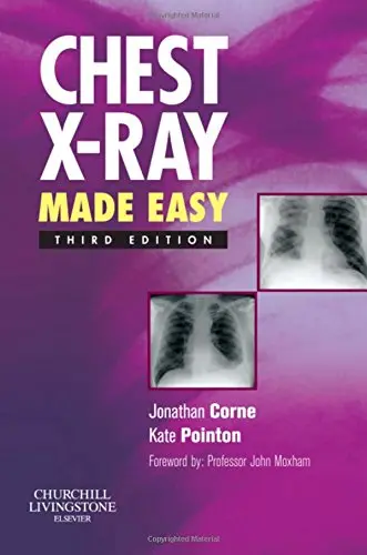 Cover of Chest X-Ray Made Easy