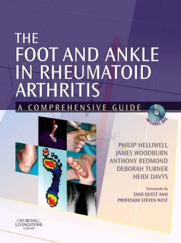 Cover of The Foot and Ankle in Rheumatoid Arthritis