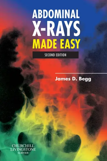 Cover of Abdominal X Rays Made Easy 2Ed