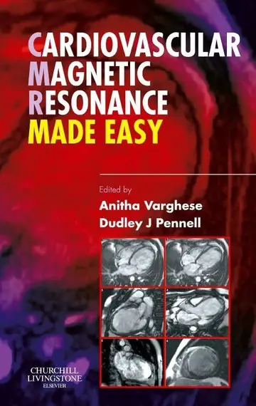 Cover of Cardiovascular Magnetic Resonance Made Easy