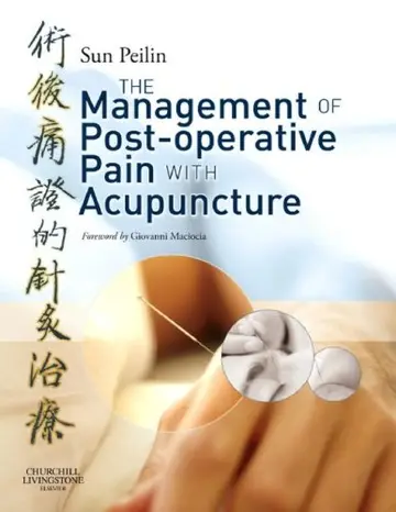 Cover of Management of Post-operative Pain with Acupuncture