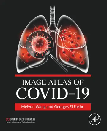 Cover of Image Atlas of Covid-19, 1St Edition