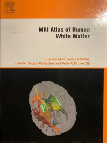 Cover of MRI Atlas of Human White Matter