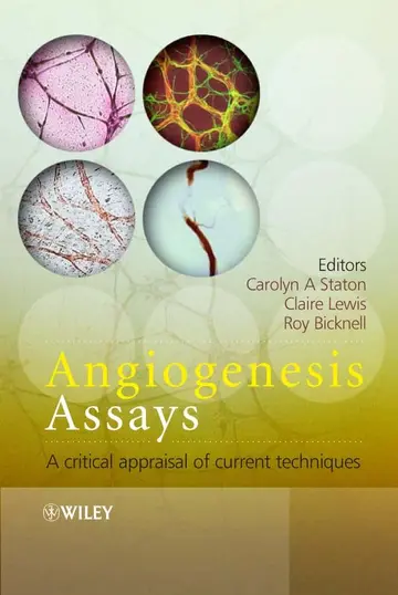 Cover of Angiogenesis Assays