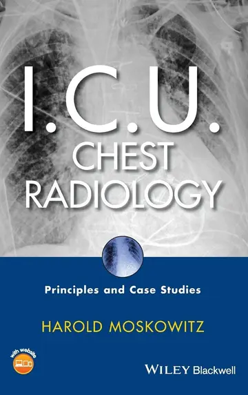 Cover of I.C.U. Chest Radiology