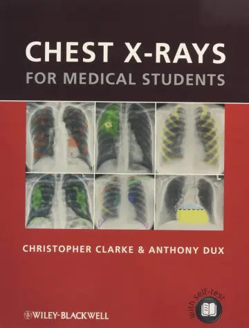 Cover of Chest X-Rays for Medical Students