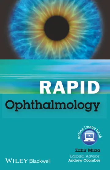 Cover of Rapid Ophthalmology