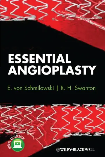 Cover of Essential Angioplasty