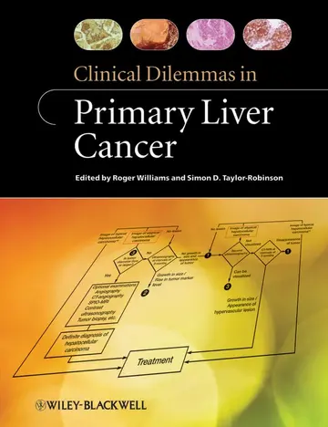 Cover of Clinical Dilemmas in Primary Liver Cancer (Clinical Dilemmas (UK))