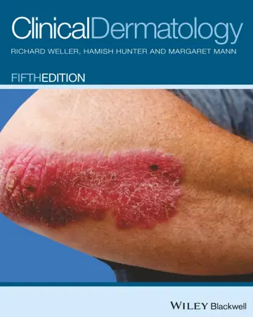 Cover of Clinical Dermatology 5Ed (Pb 2015) Special Price