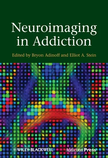 Cover of Neuroimaging in Addiction