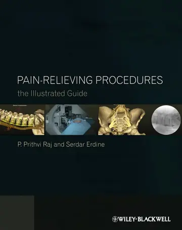 Cover of Pain-Relieving Procedures