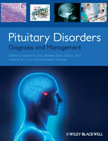 Cover of Pituitary Disorders