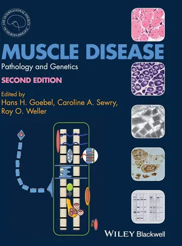 Cover of Muscle Disease
