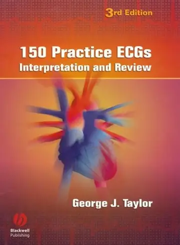 Cover of 150 Practice Ecgs