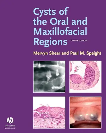 Cover of Cysts of the Oral and Maxillofacial Regions