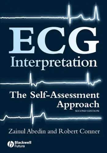 Cover of ECG Interpretation