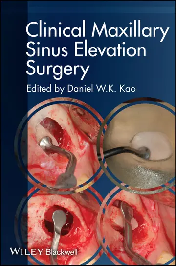 Cover of Clinical Maxillary Sinus Elevation Surgery
