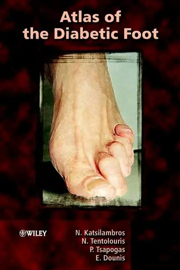 Cover of Atlas of the Diabetic Foot
