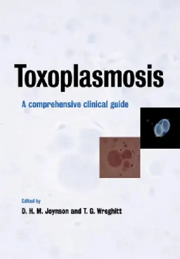 Cover of Toxoplasmosis