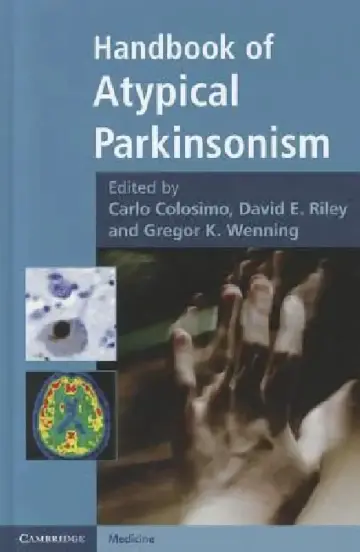 Cover of Handbook of Atypical Parkinsonism