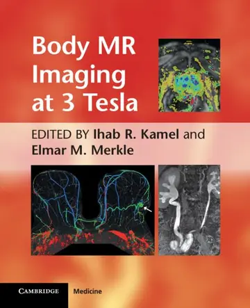 Cover of Body MR Imaging at 3 Tesla