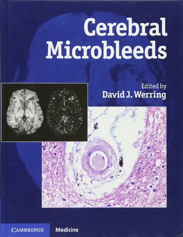 Cover of Cerebral Microbleeds