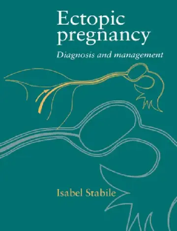 Cover of Ectopic Pregnancy