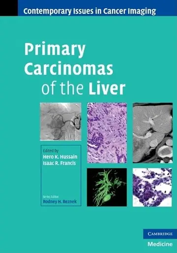 Cover of Primary Carcinomas of the Liver
