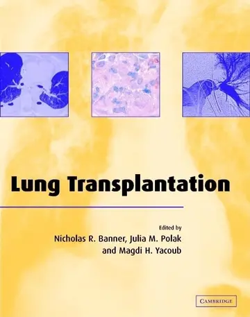 Cover of Lung Transplantation