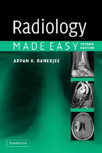 Cover of Radiology Made Easy
