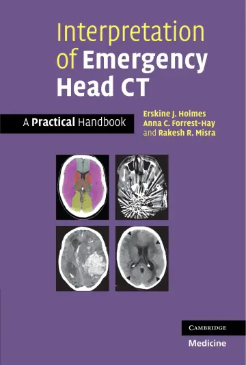 Cover of Interpretation of Emergency Head CT