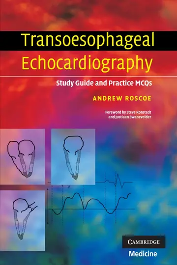 Cover of Transoesophageal Echocardiography