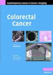 Cover of Colorectal Cancer