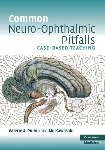 Cover of Common Neuro-Ophthalmic Pitfalls