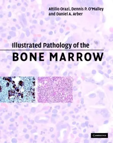Cover of Illustrated Pathology of the Bone Marrow