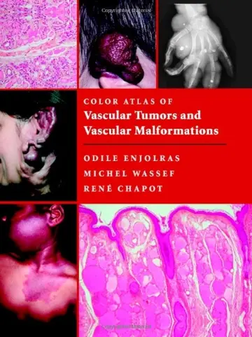 Cover of Color Atlas of Vascular Tumors and Vascular Malformations