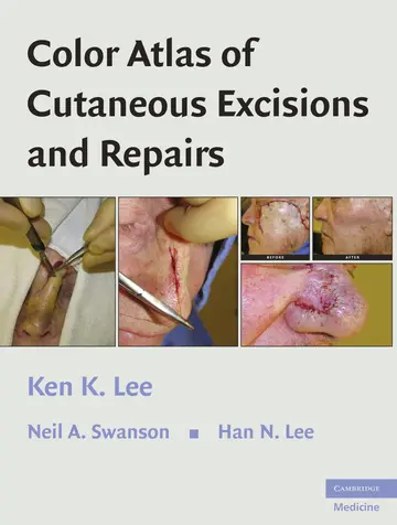 Cover of Color Atlas of Cutaneous Excisions and Repairs