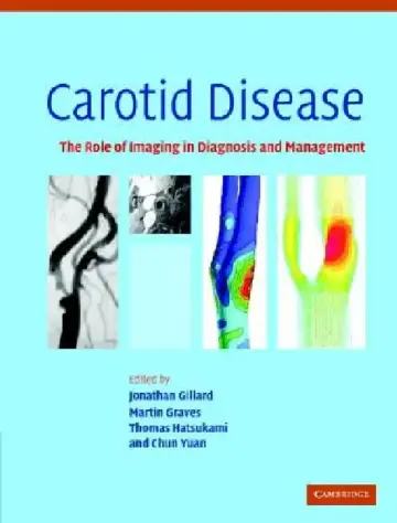 Cover of Carotid Disease