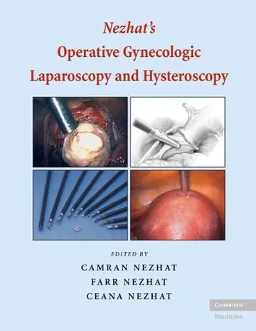 Cover of Nezhat's Operative Gynecologic Laparoscopy and Hysteroscopy