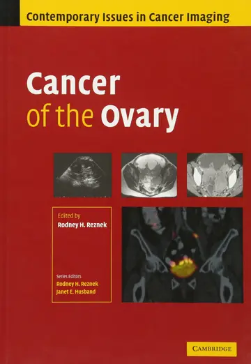 Cover of Cancer of the Ovary