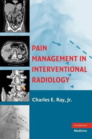 Cover of Pain Management in Interventional Radiology
