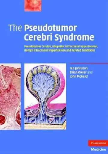 Cover of The Pseudotumor Cerebri Syndrome