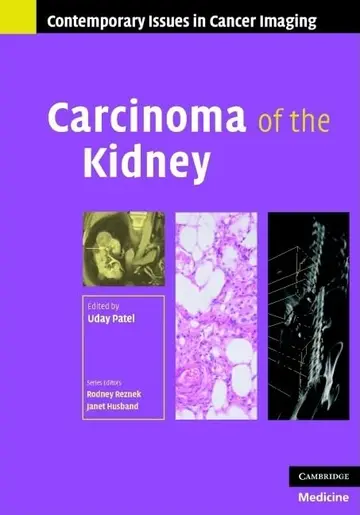 Cover of Carcinoma of the Kidney