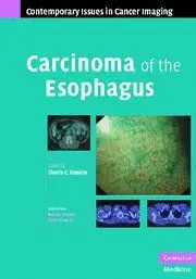 Cover of Carcinoma of the Esophagus
