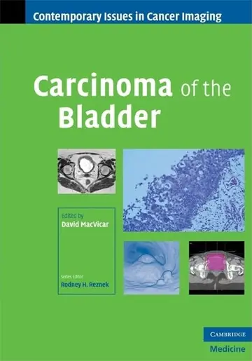 Cover of Carcinoma of the Bladder