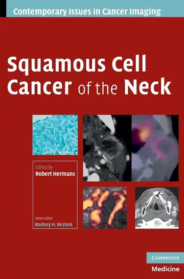 Cover of Squamous Cell Cancer of the Neck
