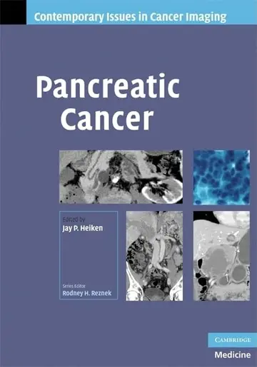 Cover of Pancreatic Cancer